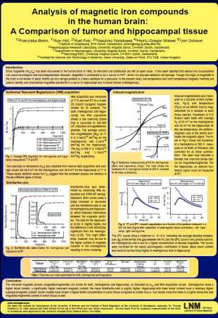 Magnetic iron compounds in the human brain